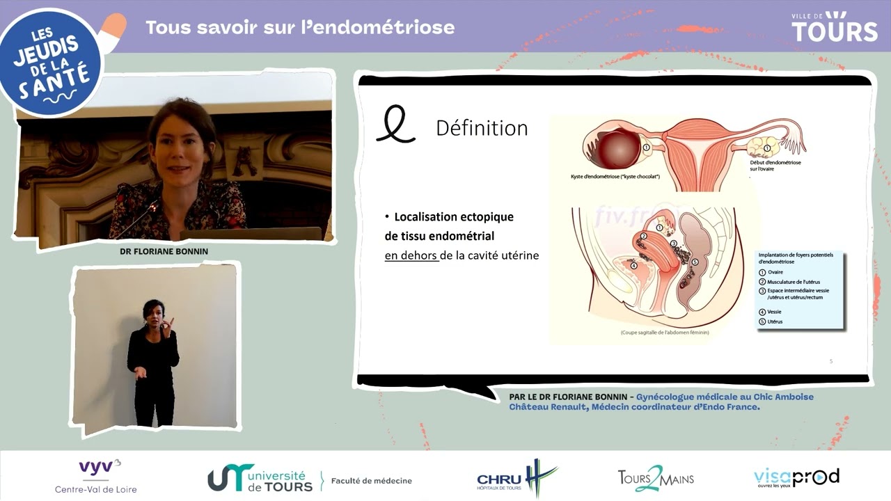 Jeudi de la santé - Tout savoir sur l’endométriose