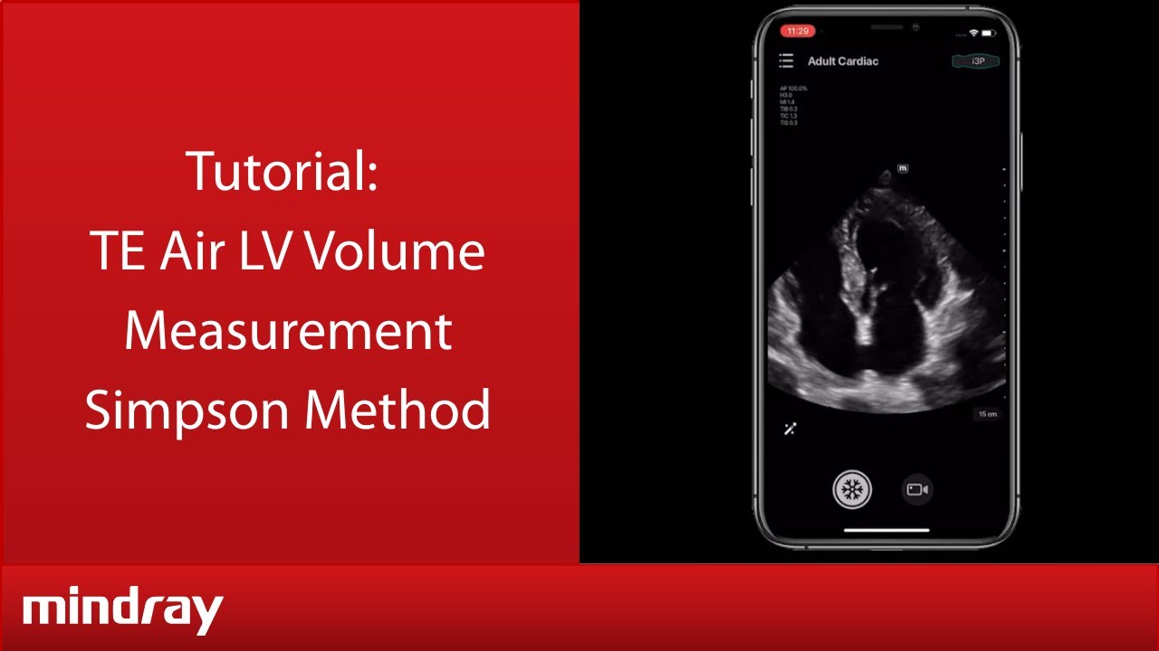 Mindray TE Air Tutorial - LV Volume Measurement Simpson Method