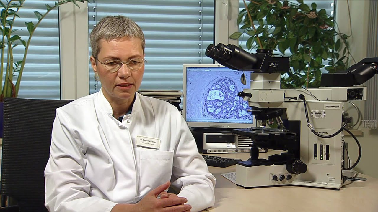 Brustkrebs - Ist der Tumor gut- oder bösartig?