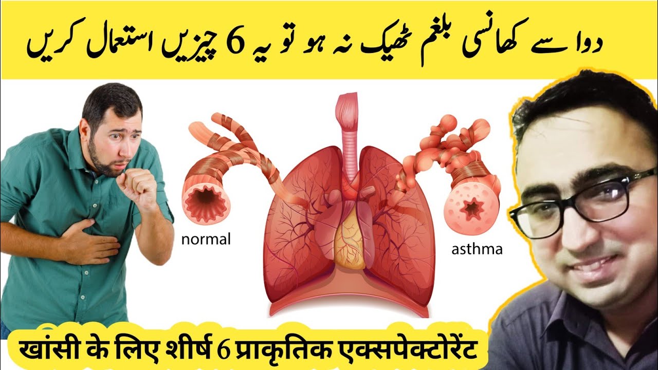 Top 6 Natural Expectorant Remedies For Mucus & Phlegm In Chronic Cough