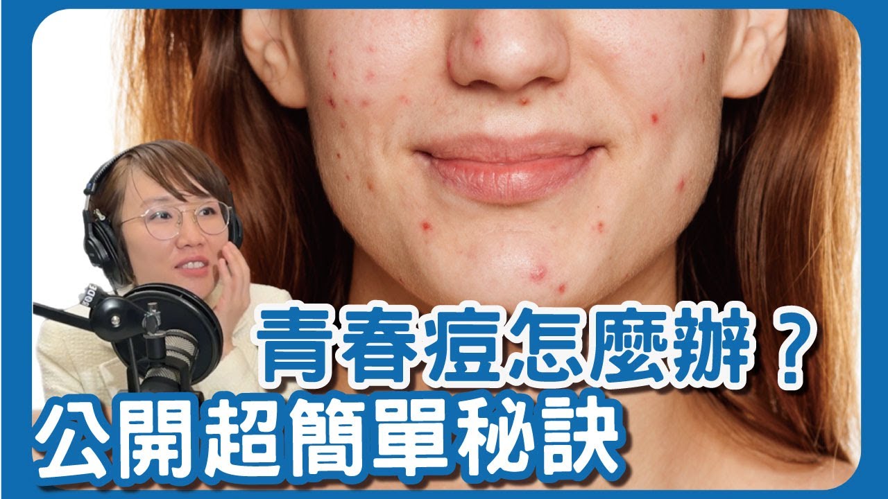 逆轉青春痘變好的秘密，居然那麼簡單？！你我皆能做到！