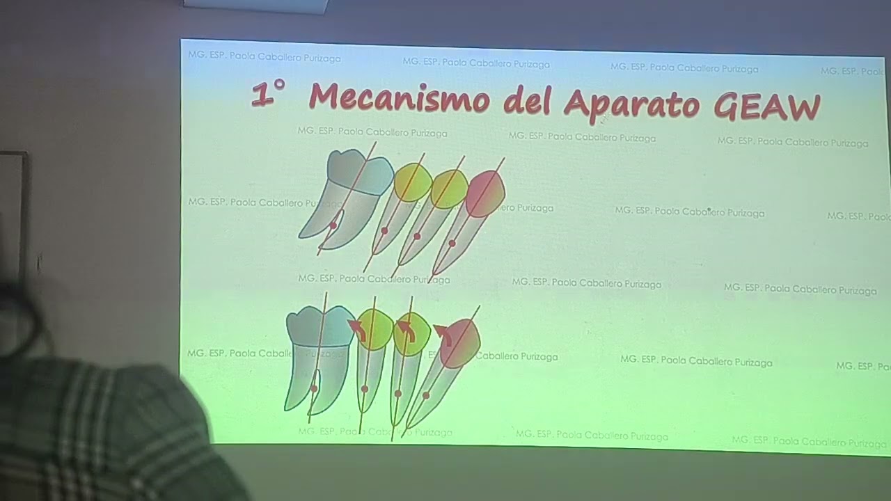 Aparatología GEAW  GUMMETAL Edgewise arch wire