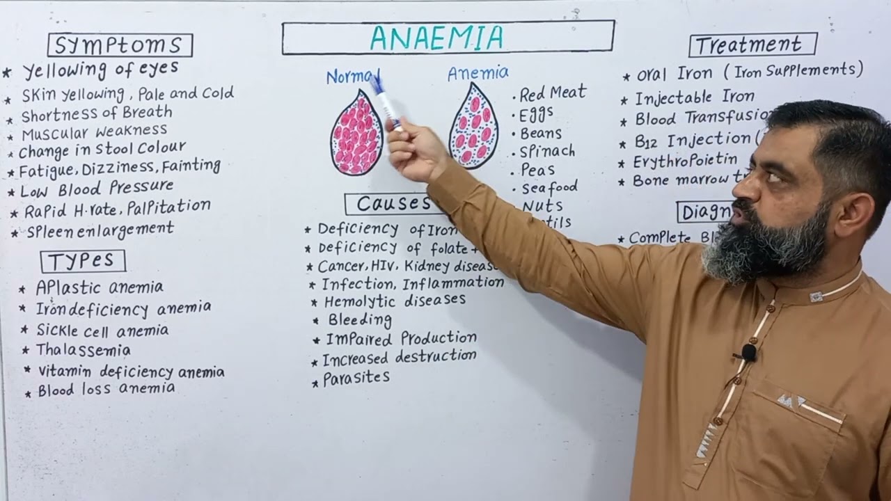 Anaemia Urdu/Hindi medium @prof.masoodfuzail#anaemia #anemiaproblems #anemiatreatment #anemia