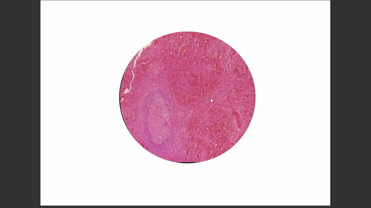 Pathology 1 practical section - fourth and fifth sessions