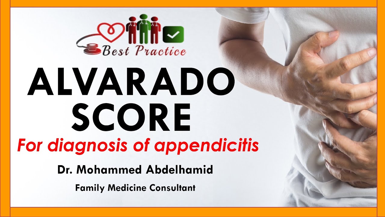 Alvarado Score For Diagnosis Of Appendicitis, Dr Mohammed Abdelhamid