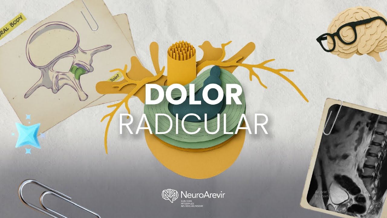 ANATOMÍA DE UN CASO | Dolor radicular