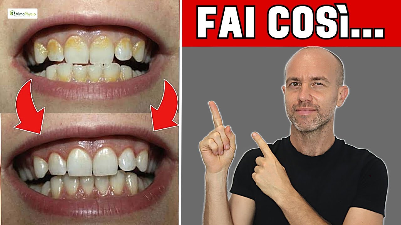 RIMEDIO NUMERO 1 contro la GENGIVITE,  PLACCA E TARTARO
