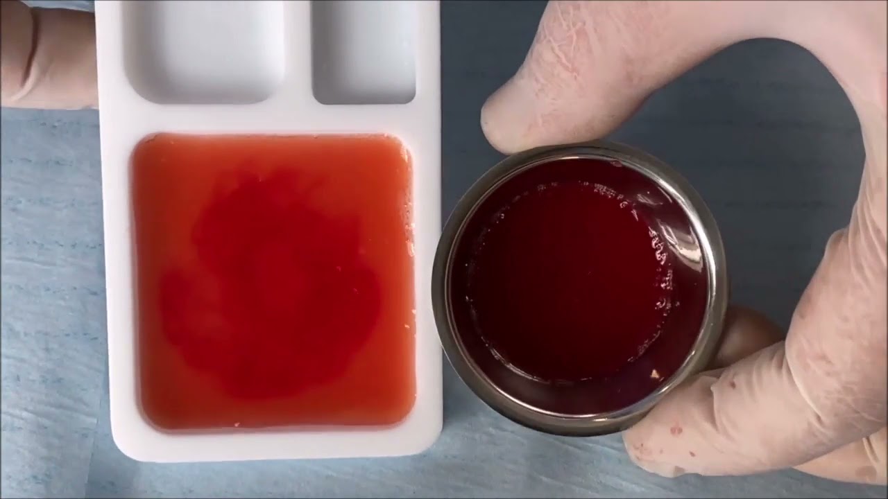 PRF Sticky Bone and Large Membrane