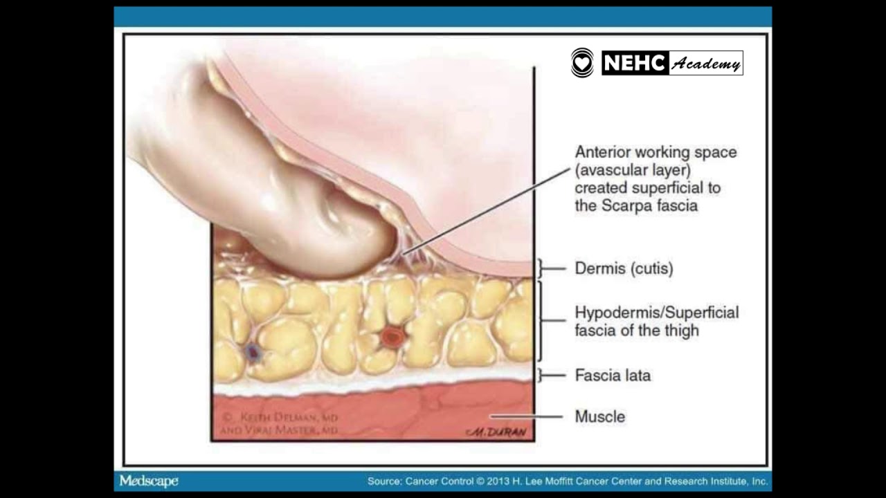 NEHC Academy Sound Healing and the Fascia Layer
