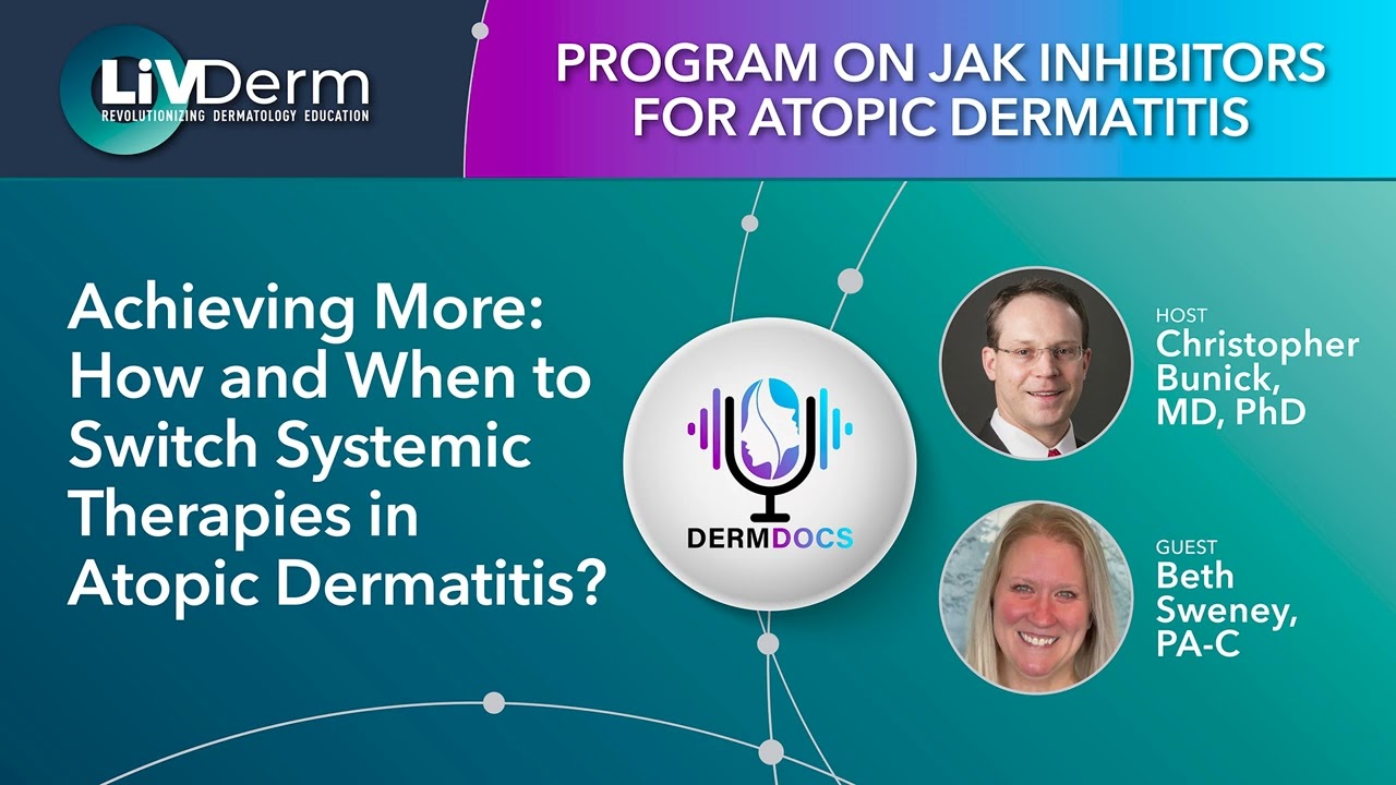 Achieving More: How and When to Switch Systemic Therapies in Atopic Dermatitis?