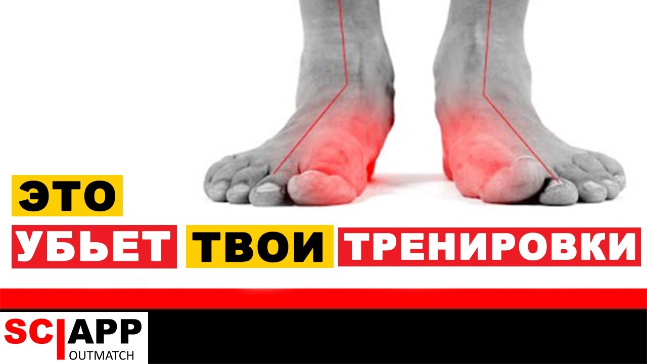 5 Способов Как Плоскостопие Убивает Твои Тренировки, Колени, Бедра и Поясницу | Джефф Кавальер