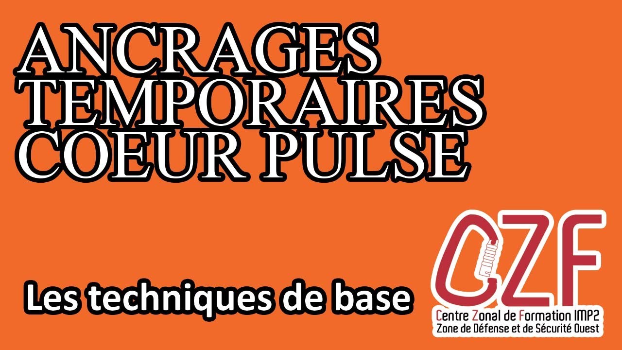 CZF-IMP2-ZDSO- 1.3.26- Tutoriel Pose d'ancrages temporaires