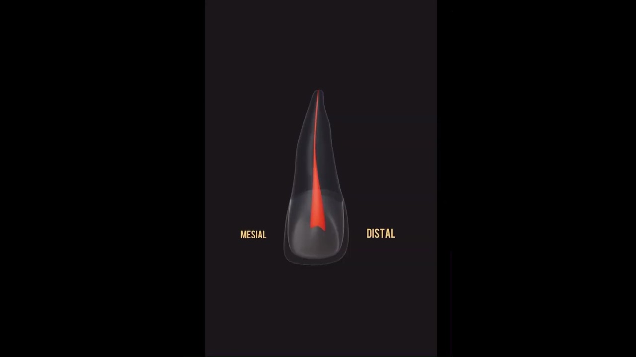 Incisivo central superior #endodoncia #odontologia #anatomiadental