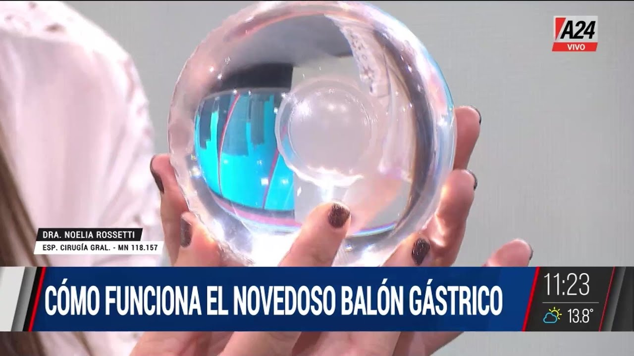 Cómo funciona el balón gástrico que se ingiere y se elimina solo