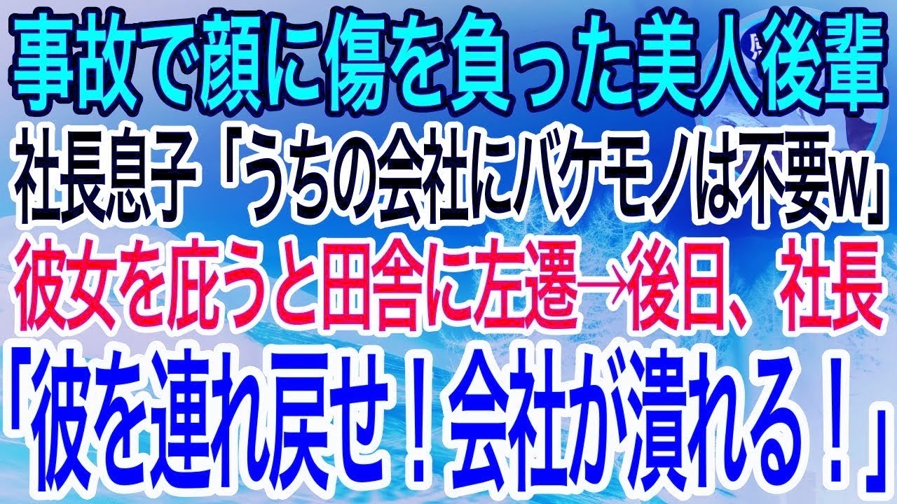 【感動】事故で顔に傷を負った美人後輩に社長息子「うちの会社にバケモノは不要w」彼女を庇うとド田舎に左遷された→数日後、社長「彼を連れ戻せ！」衝撃の展開にw【泣ける話】【良い話】