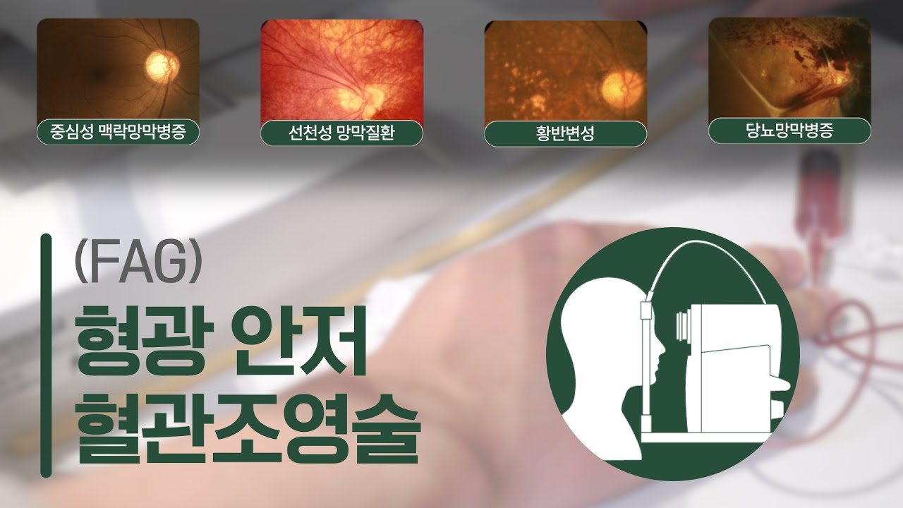 망막 질환 진단에 꼭 필요한 검사! 형광안저혈관조영술 완벽 설명