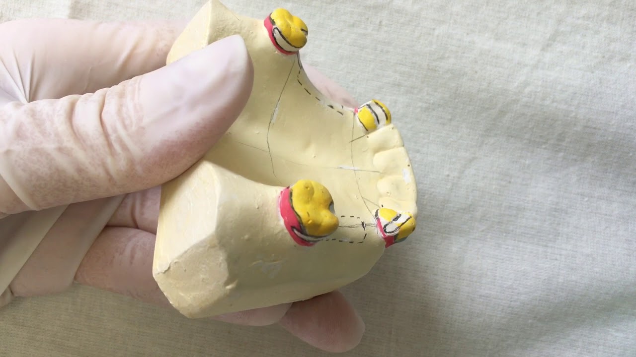 desenho de armação metálica de PPR modelo classe III