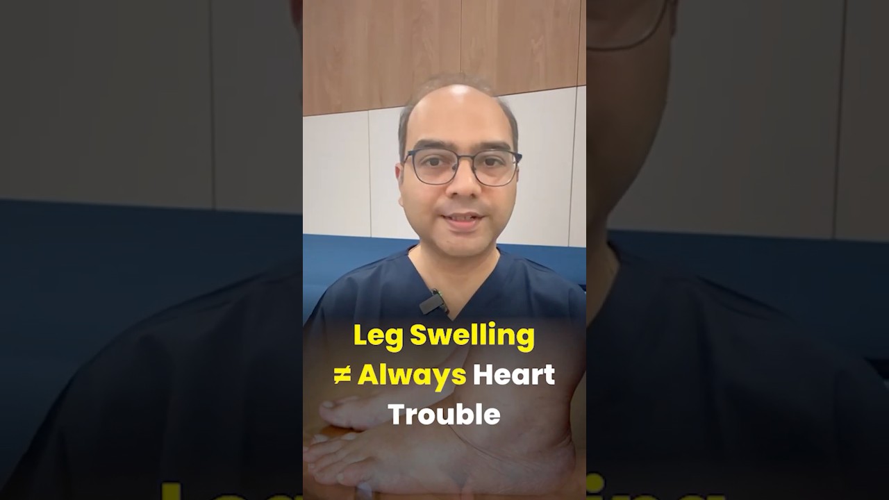 Swollen Ankles? It&rsquo;s Not Always Your Heart! | Venous Edema vs Heart Failure Explained #swollenankles