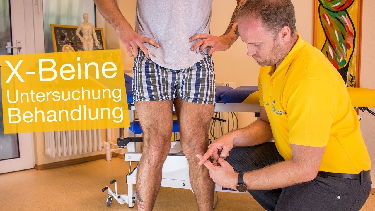 X-Beine ❌ Was wirklich hilft: Ursachen | Untersuchung | Therapie (OP) | Übungen