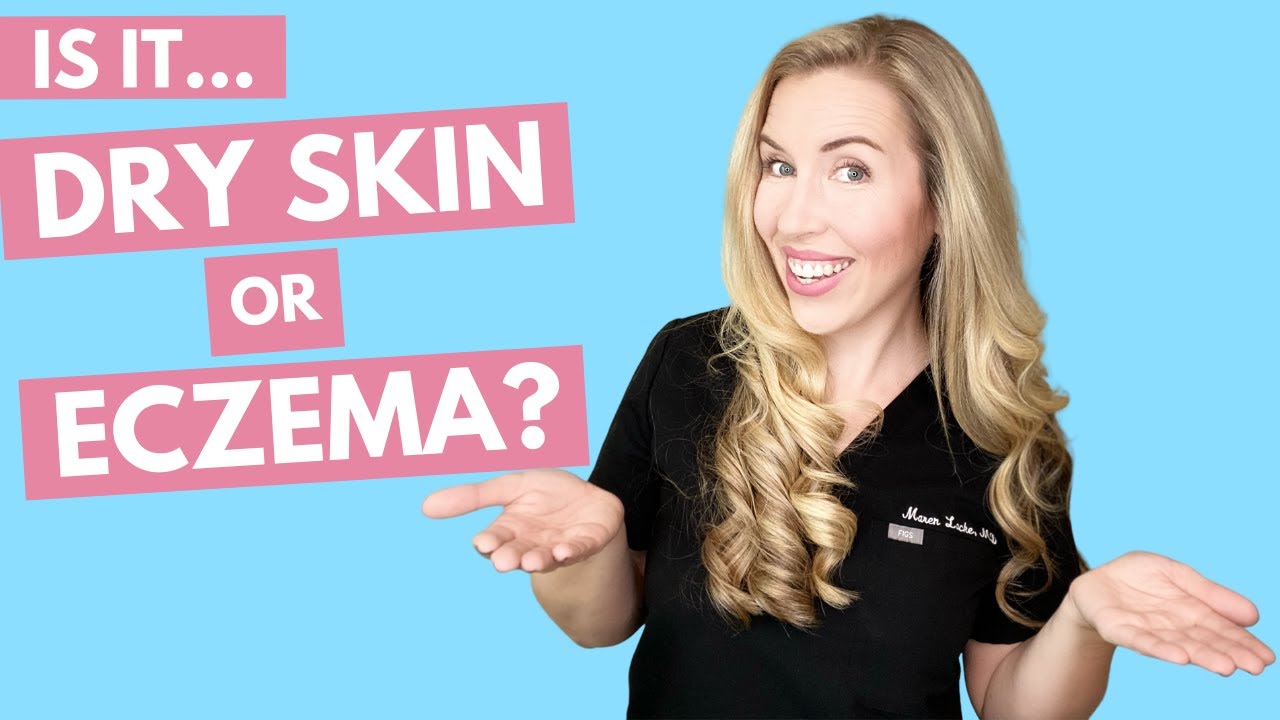 Сухая кожа или экзема? | Как лечить с помощью доступных продуктов!