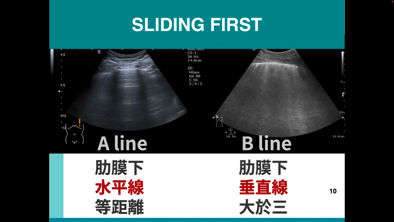 Basic Lung US & BLUE protocol