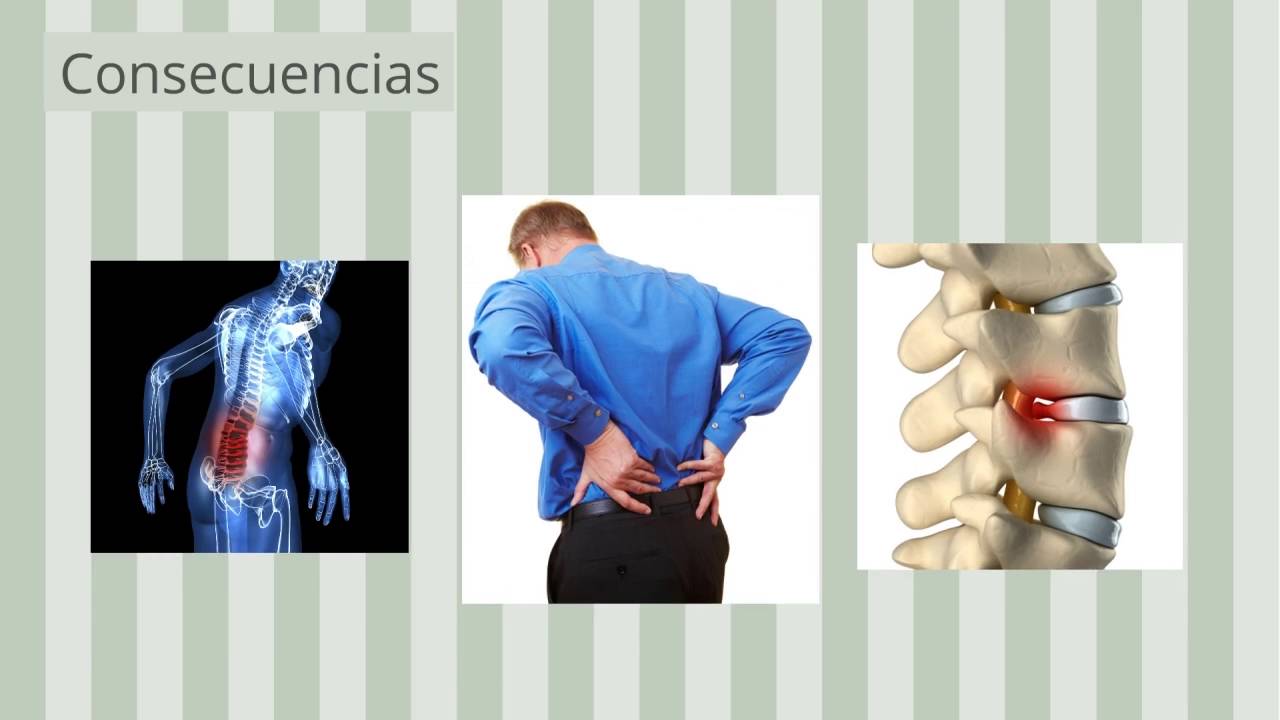 Riesgos Biomecánicos ergonómicos sobreesfuerzos
