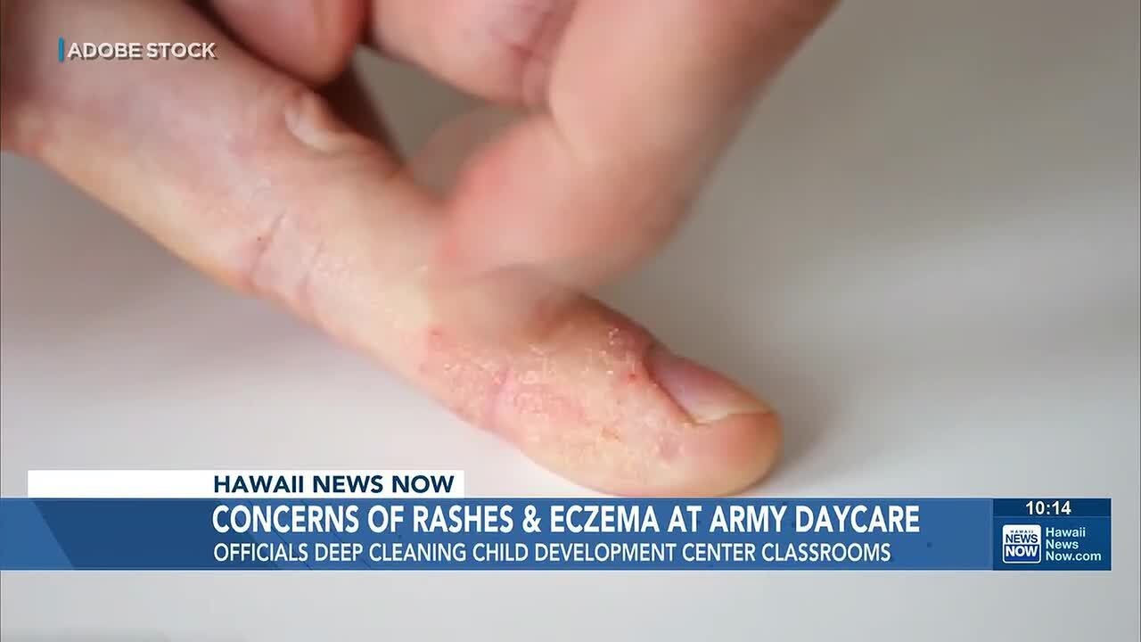 Army day care classrooms getting deep-cleaned after reports of rashes