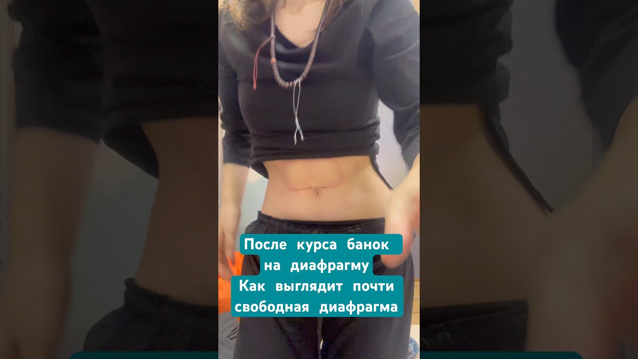 #вакуумныбанки