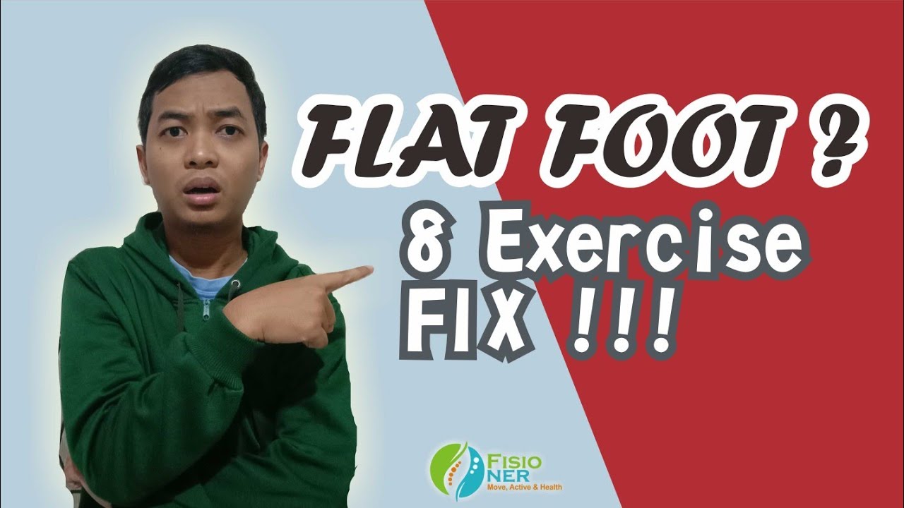 Solusi Mengatasi Flat Foot atau Telapak Kaki Datar