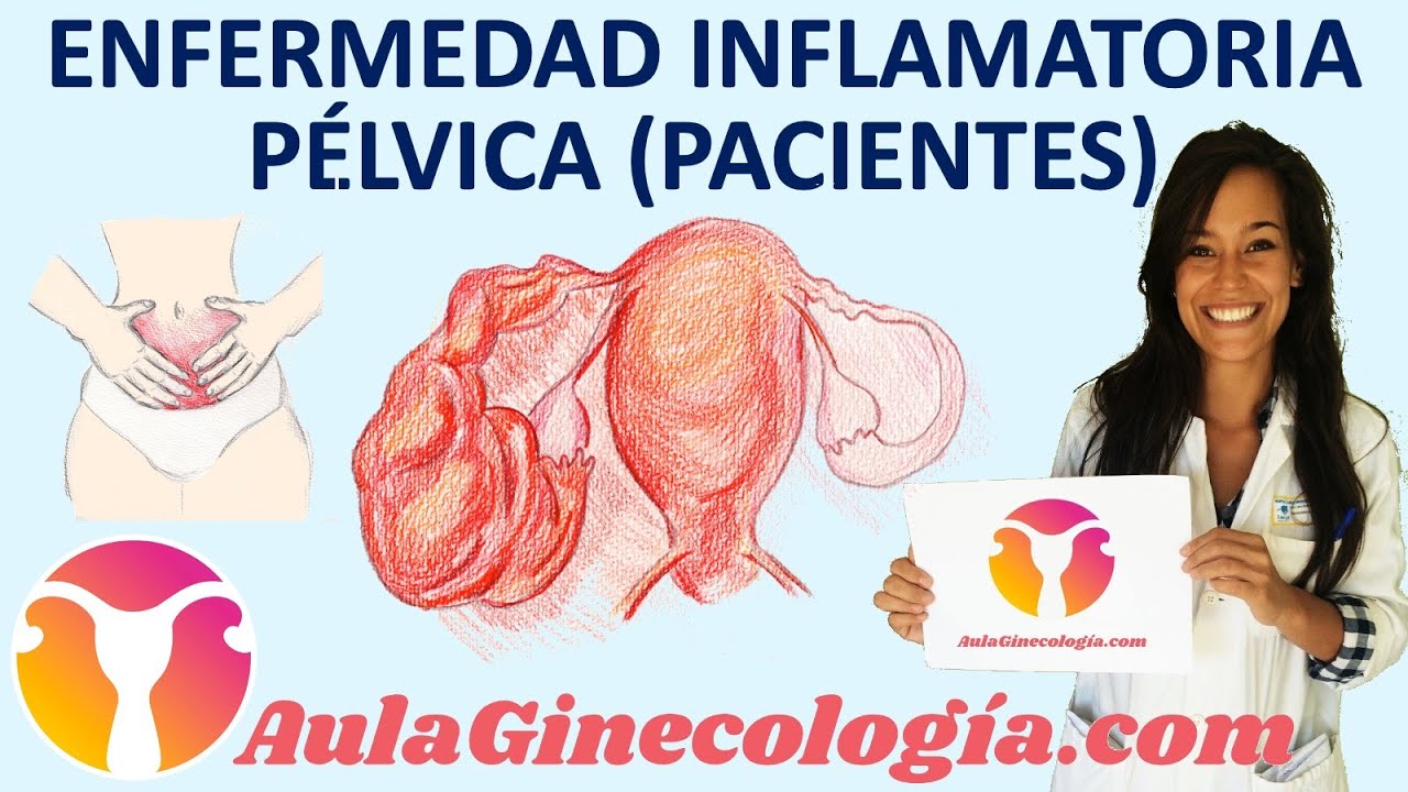 ENFERMEDAD INFLAMATORIA P&Eacute;LVICA (EPI) PACIENTES: s&iacute;ntomas y tratamiento- Ginecolog&iacute;a y Obstetricia -