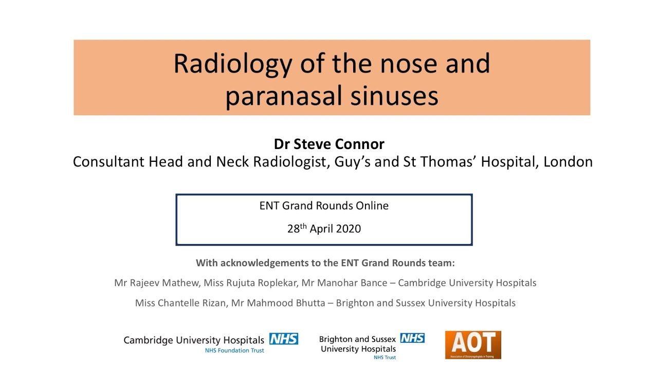 Rhinology | Radiology of the nose and paranasal sinuses | Dr Steve Connor