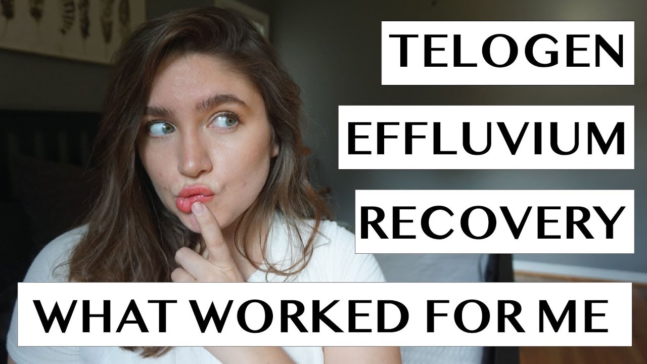 TELOGEN EFFLUVIUM RECOVERY | WHAT WORKED FOR ME | NO B.S. HAIR REGROWTH TIPS | LAUREN NEWLY