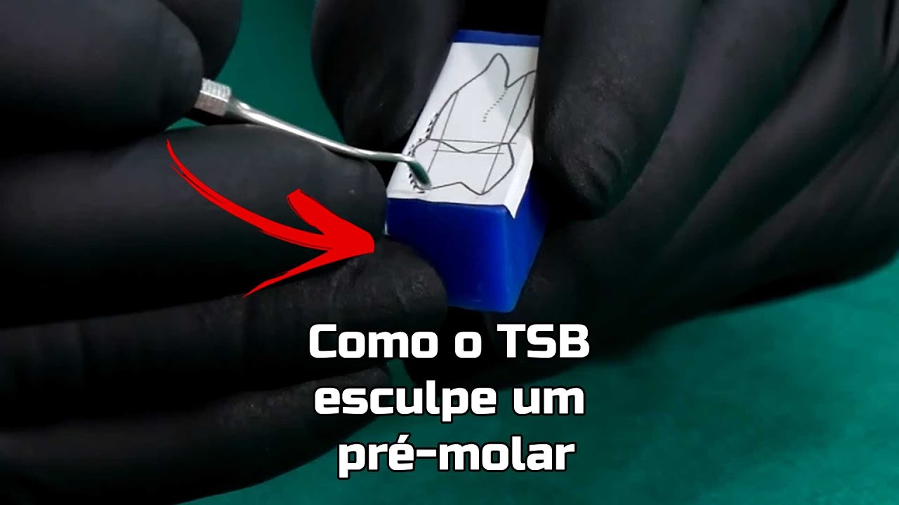 Esculpindo dente em cera - parte 2 - O pré-molar