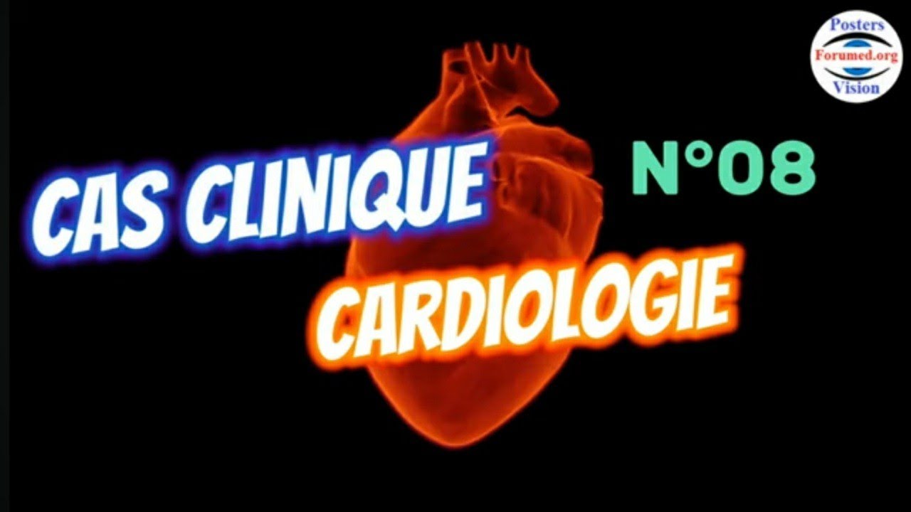 Cas Clinique de Cardiologie sur l'infarctus du myocarde QCM avec R&eacute;ponses et explications