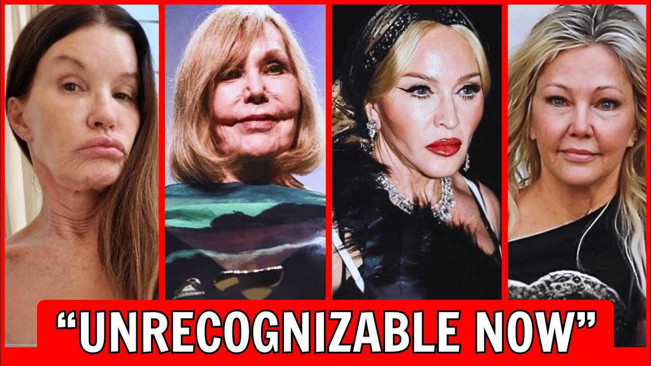 35 Celebrity Plastic Surgery Stories That Surprised Everyone | Then and Now Celebs 2026