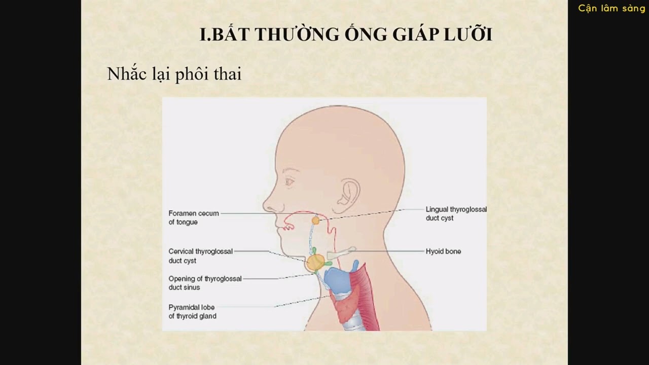TỔN THƯƠNG DẠNG NANG VÙNG CỔ Ở TRẺ SƠ SINH | SIÊU ÂM CHẨN ĐOÁN | Bs CK2. Nguyễn Hữu Chí