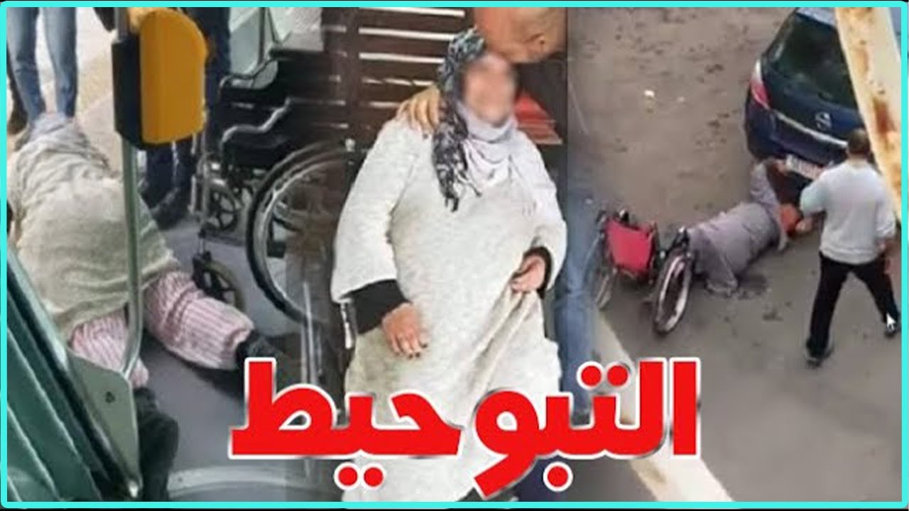 أحضي راسك من التبوحيط