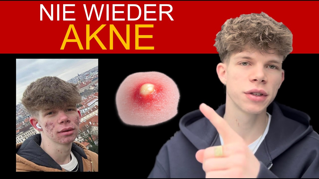 Was ich esse, wenn meine Haut schlechter wird (neu!)