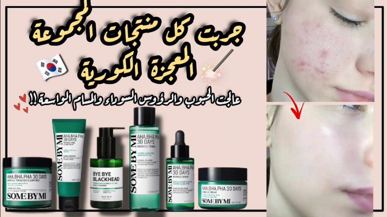 العلاج السحري للحبوب | افضل منتجات كورية لعلاج الحبوب والرؤوس السوداء | Some by mi 30 days miracle