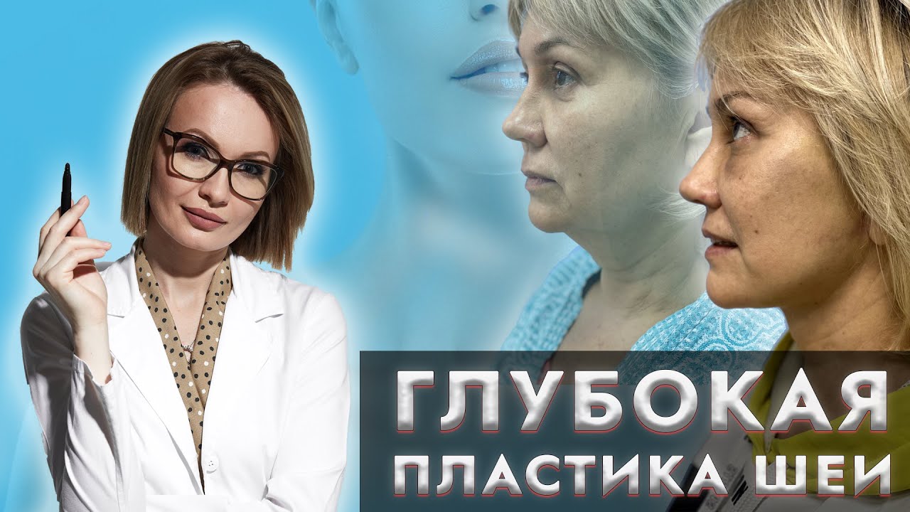 Глубокая пластика шеи. Зачем? Лифтинг шеи, восстановление овала лица. Результат ДО и ПОСЛЕ.