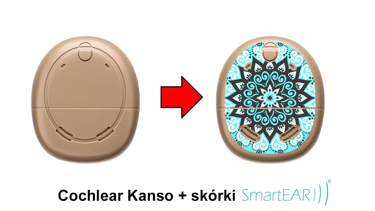 Oklejanie procesora Cochlear Kanso sk&oacute;rkami SmartEar