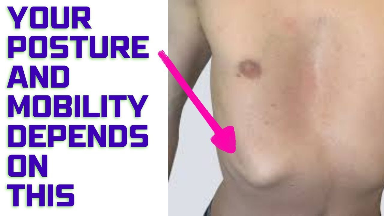 Fix Rib Flare with Two Simple Drills