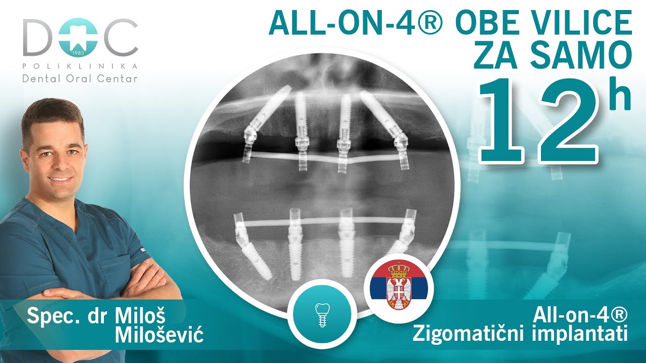 Zigomatični implanti - All-on-4® procedura -  Novi zubi za 12h - Spec dr Miloš Milošević