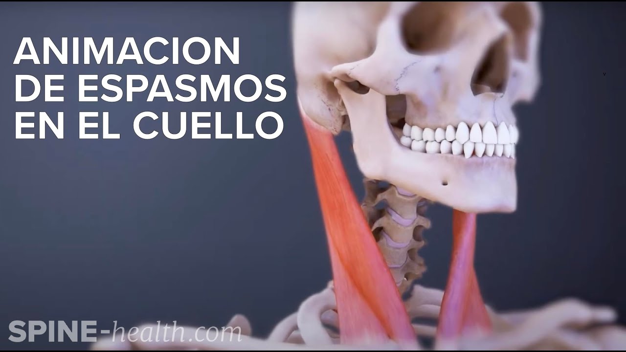 Animación de Espasmos en El Cuello
