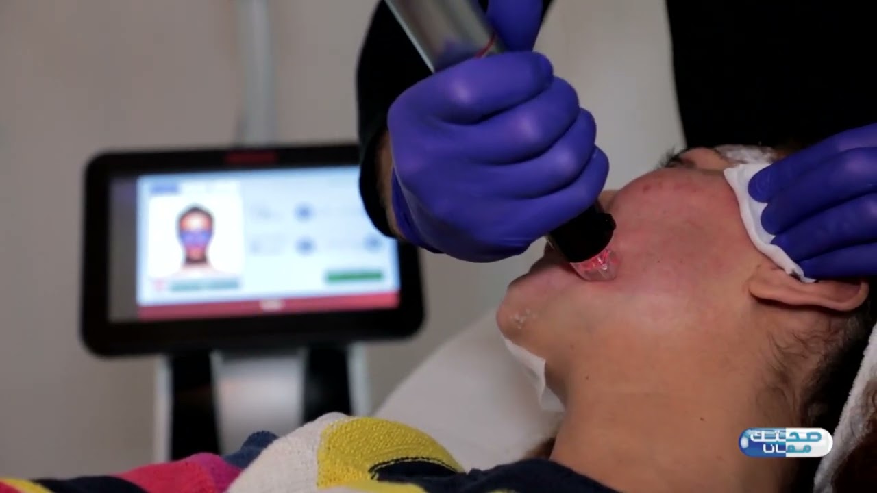 ‎نحكيو على الـ micro needling. تدخل طبي للعناية بالبشرة! مع ديدا في تنجح