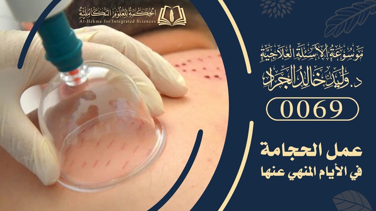 السؤال [69] [5-16]:هل يمكن عمل الحجامة في الأيام المنهي عن الحجامة فيها من باب الضرورة؟