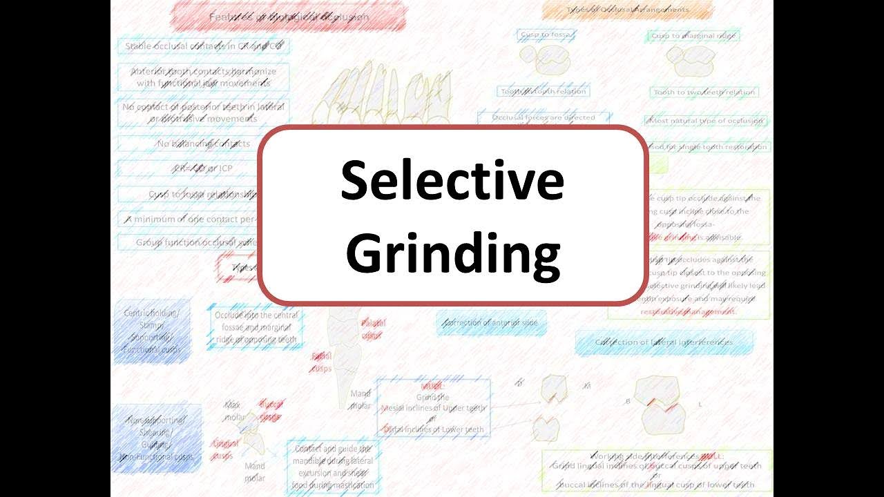 Oral rehabilitation procedure: Selective Grinding in Prosthodontics