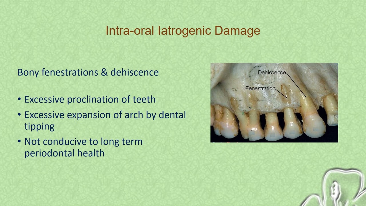 Deleterious Effects of Orthodontic Treatment