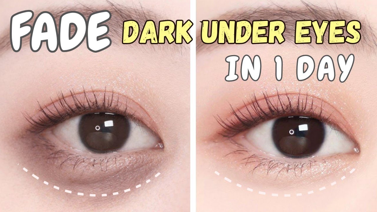 How to get rid of DARK UNDER EYES at home using easy methods | Dark circle and Eye bags 