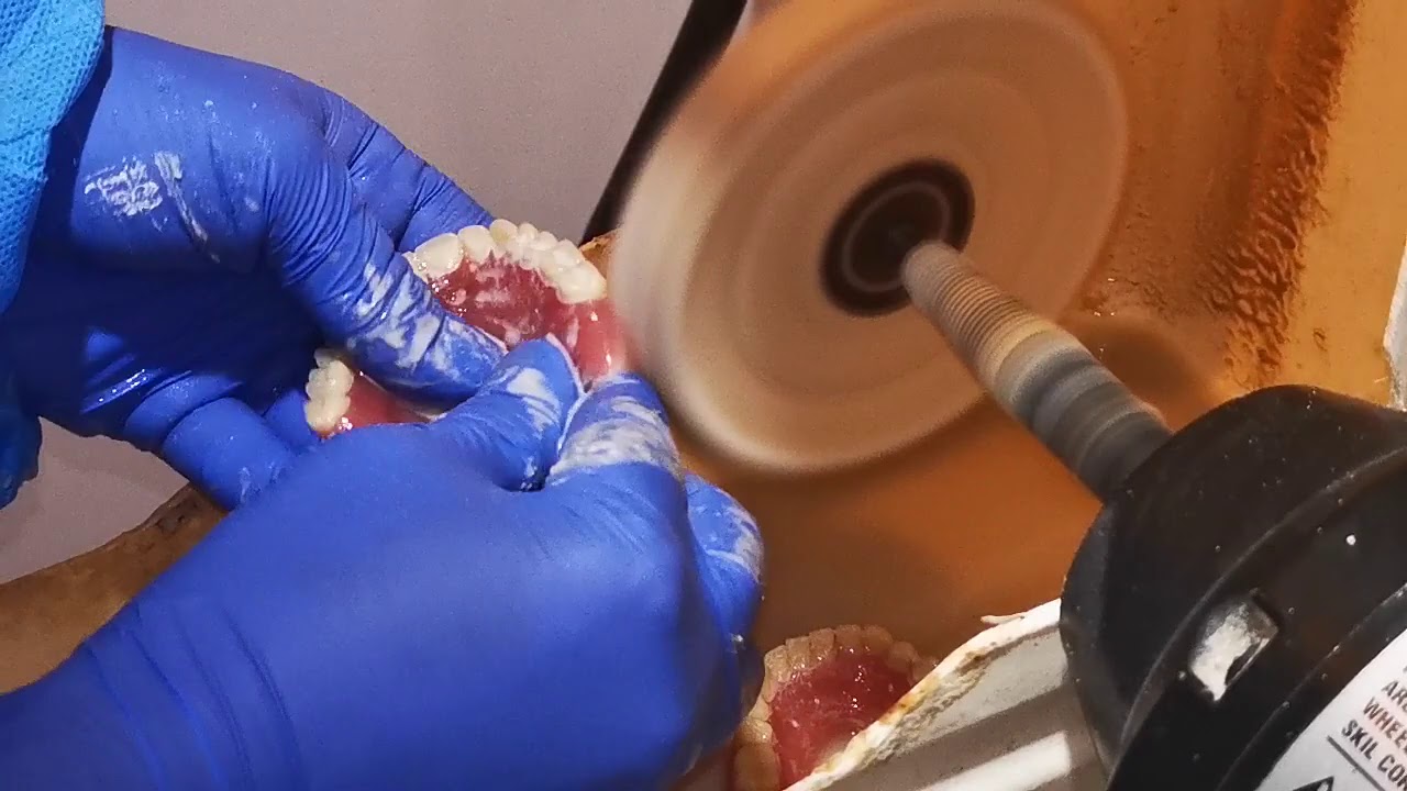 Pulido de Prótesis Dentales Acrílicas Parte I